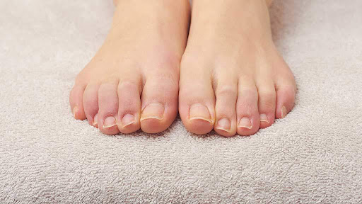 7 Tips Merawat Kesehatan Kuku Kaki